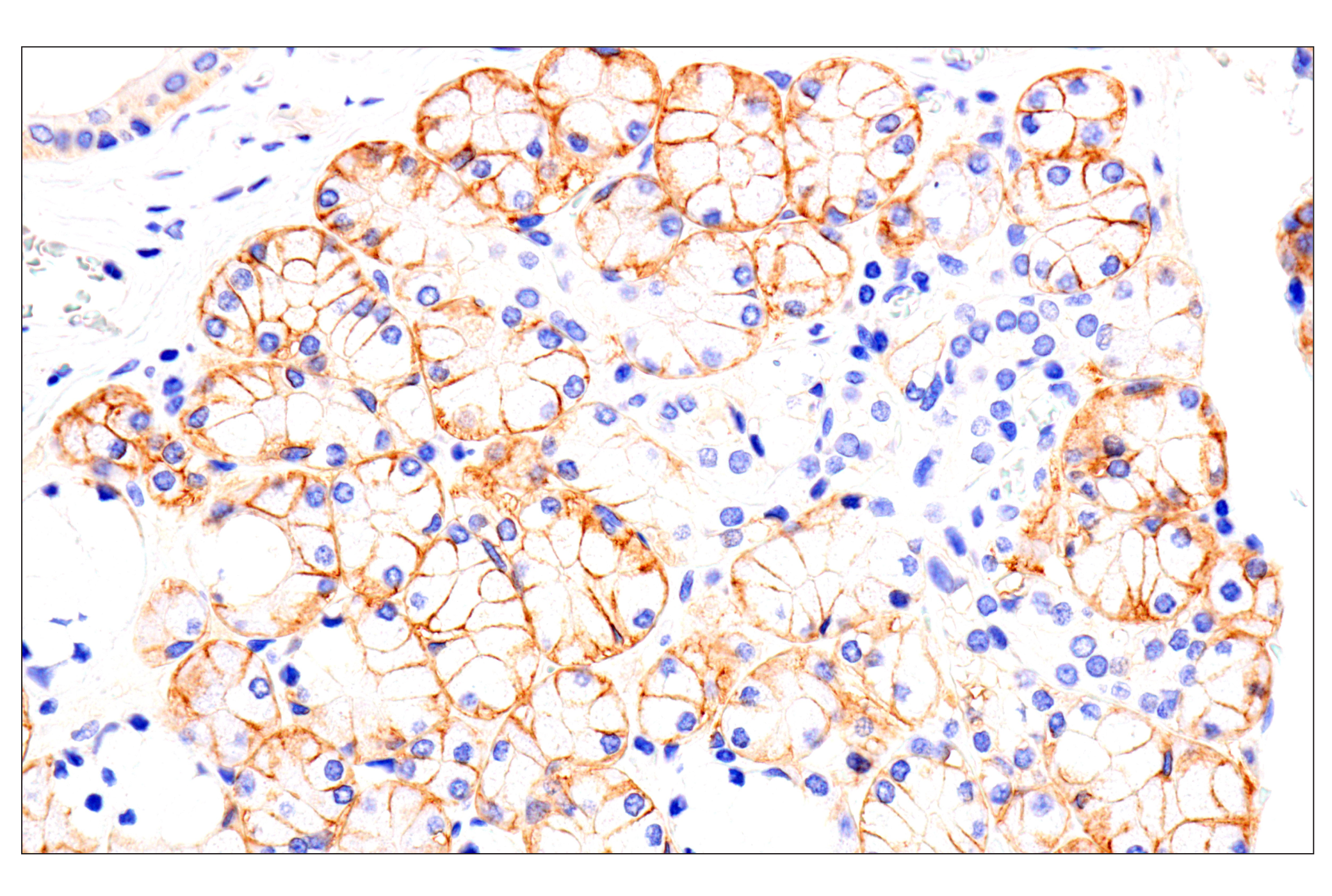 Immunohistochemistry Image 2: EphA2 (D4A2) XP® Rabbit mAb (BSA and Azide Free)
