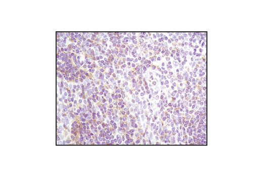 Immunohistochemistry Image 1: Lyn (C13F9) Rabbit mAb