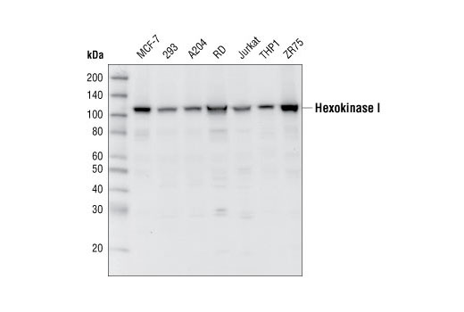 Western Blotting Image 1: Hexokinase I Antibody