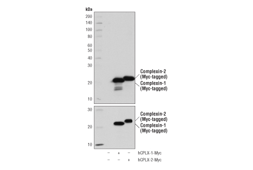 Western Blotting Image 2: Complexin-1/2 (D8A6E) Rabbit mAb