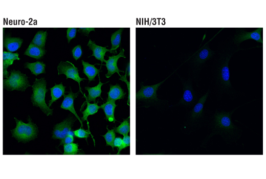 Immunofluorescence Image 1: Complexin-1/2 (D8A6E) Rabbit mAb
