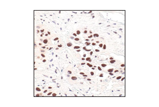 Immunohistochemistry Image 1: Survivin (71G4B7) Rabbit mAb