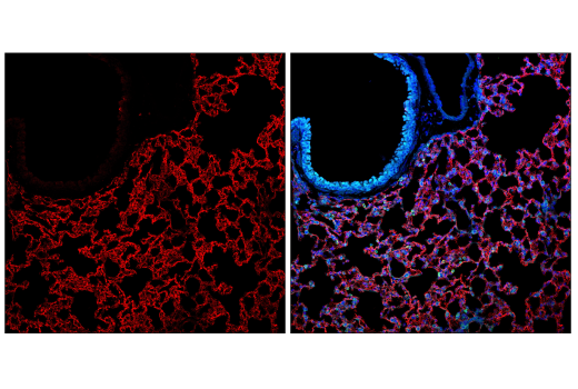 Immunofluorescence Image 1: CD36 (E8B7S) Rabbit mAb