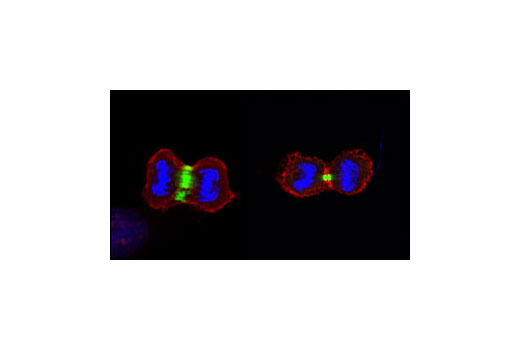 Immunofluorescence Image 1: Survivin (71G4B7) Rabbit mAb (Alexa Fluor® 488 Conjugate)
