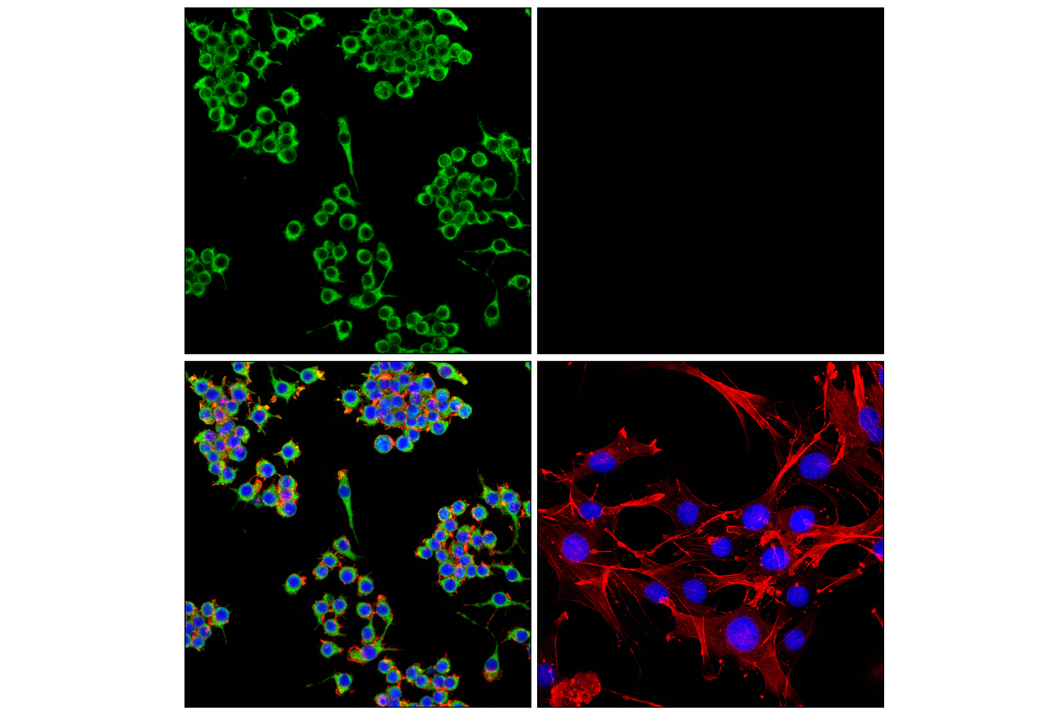 Immunofluorescence Image 4: HEXB (E9X5S) Rabbit mAb (BSA and Azide Free)