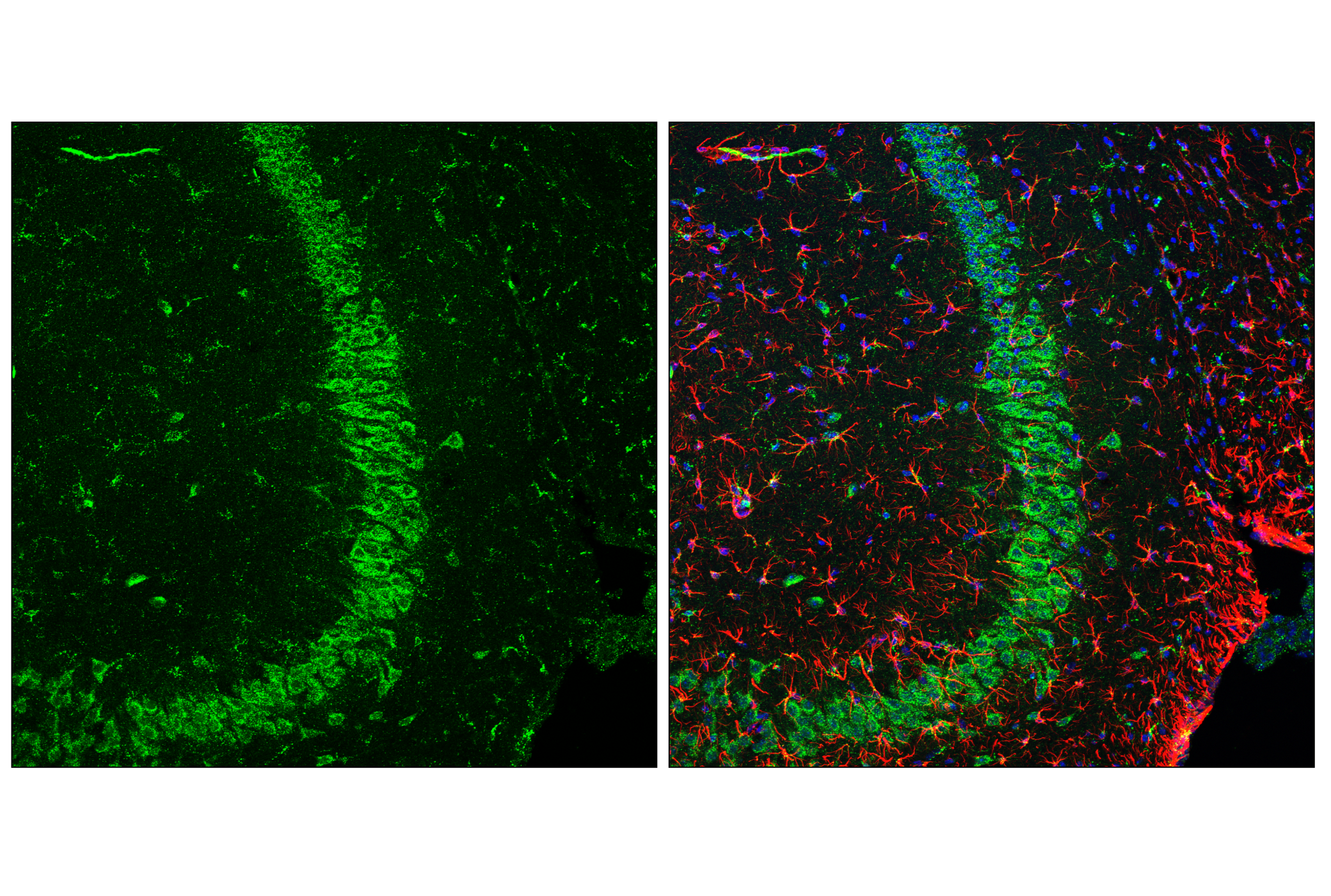 Immunofluorescence Image 2: HEXB (E9X5S) Rabbit mAb (BSA and Azide Free)