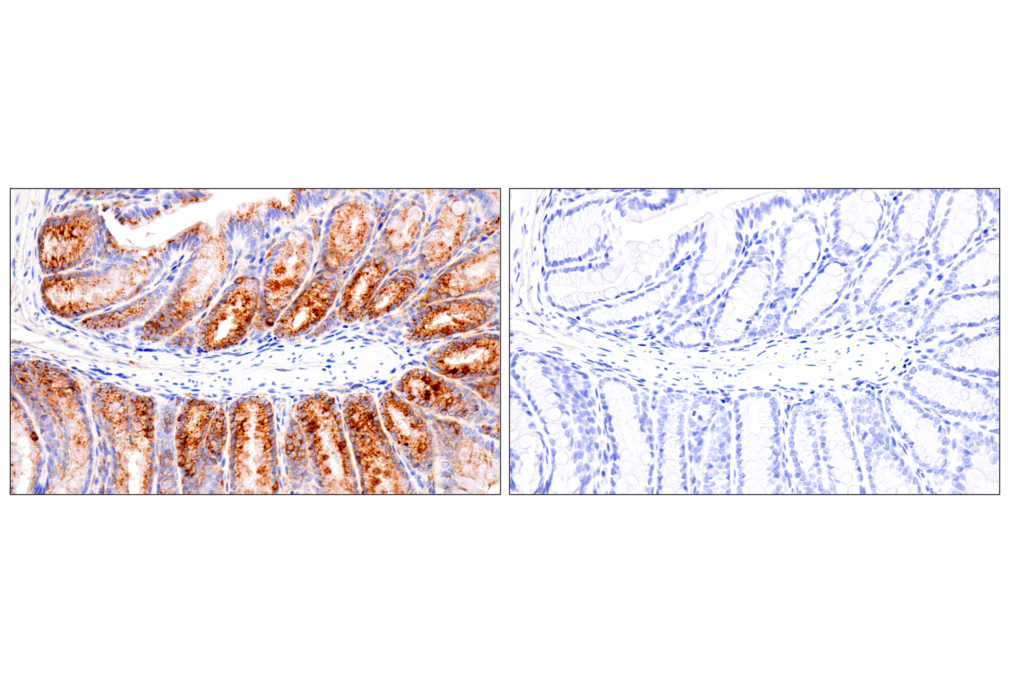 Immunohistochemistry Image 11: HEXB (E9X5S) Rabbit mAb (BSA and Azide Free)