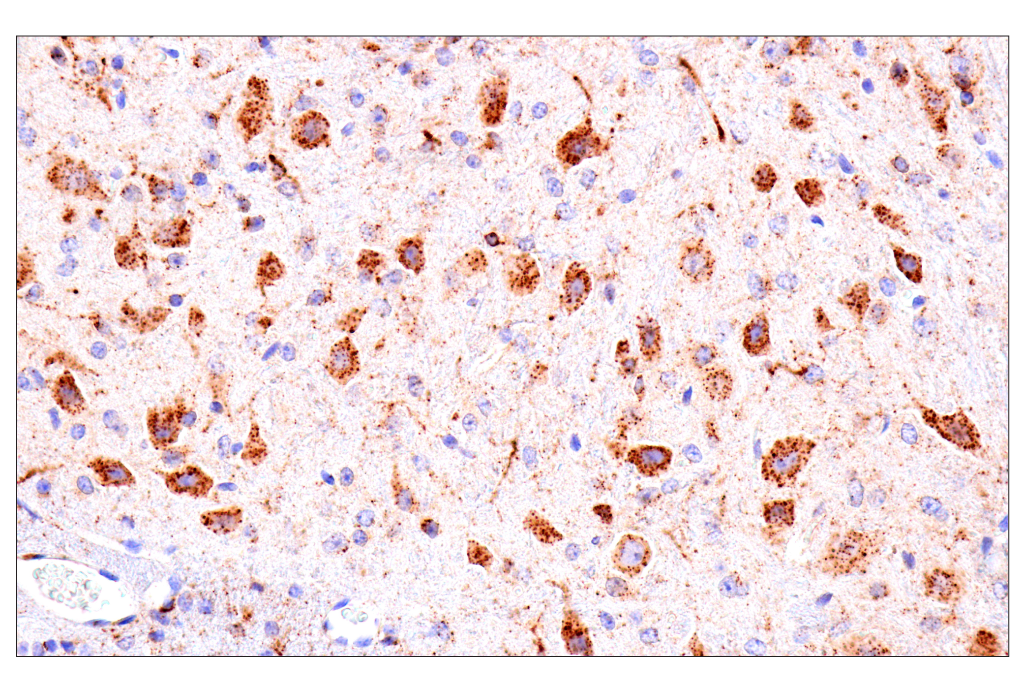 Immunohistochemistry Image 3: HEXB (E9X5S) Rabbit mAb (BSA and Azide Free)
