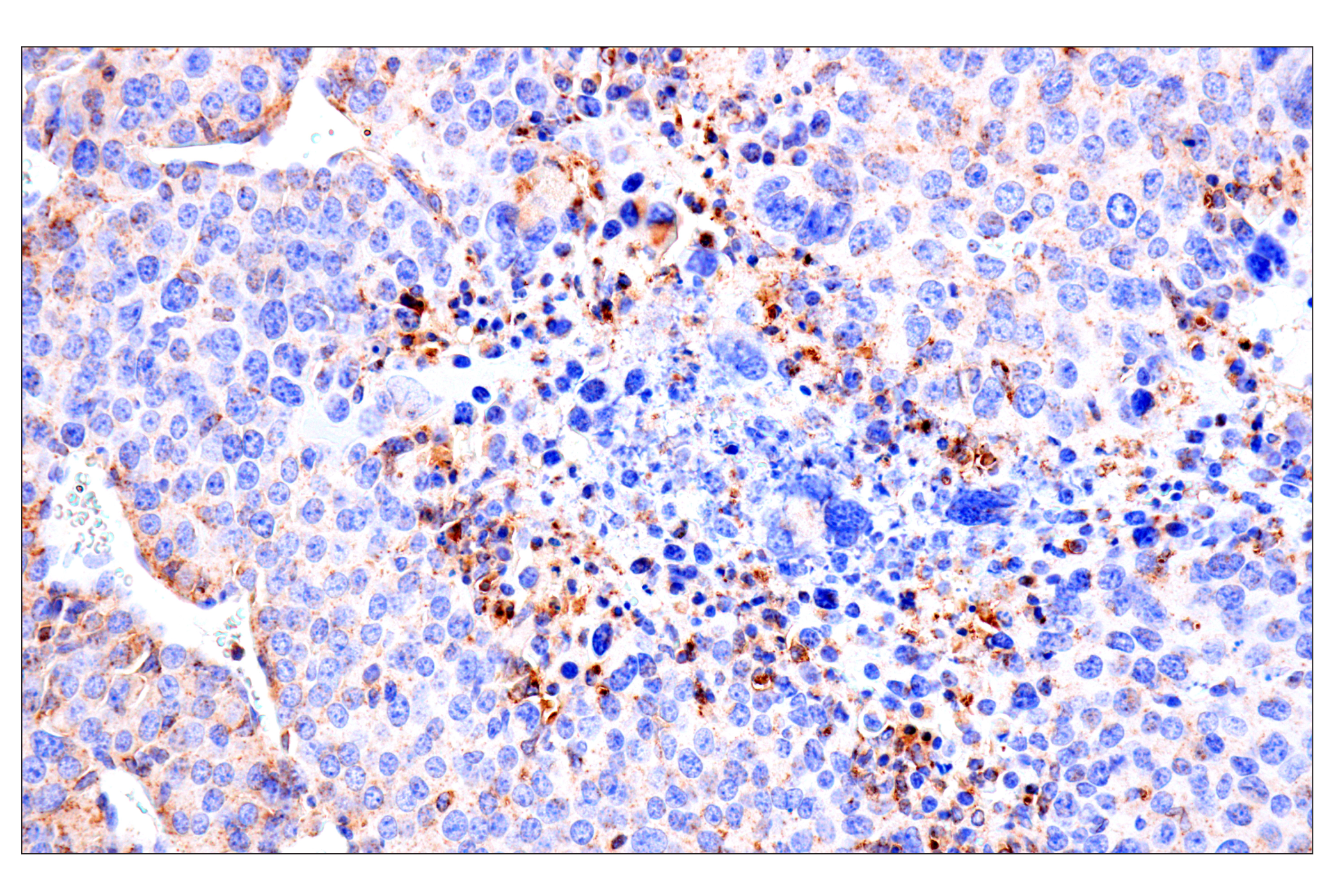 Immunohistochemistry Image 2: HEXB (E9X5S) Rabbit mAb (BSA and Azide Free)