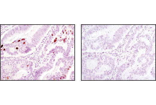 Immunohistochemistry Image 2: Phospho-Chk2 (Thr68) (C13C1) Rabbit mAb (BSA and Azide Free)