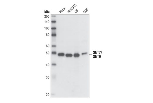  Image 3: Lysine Methyltransferase Antibody Sampler Kit