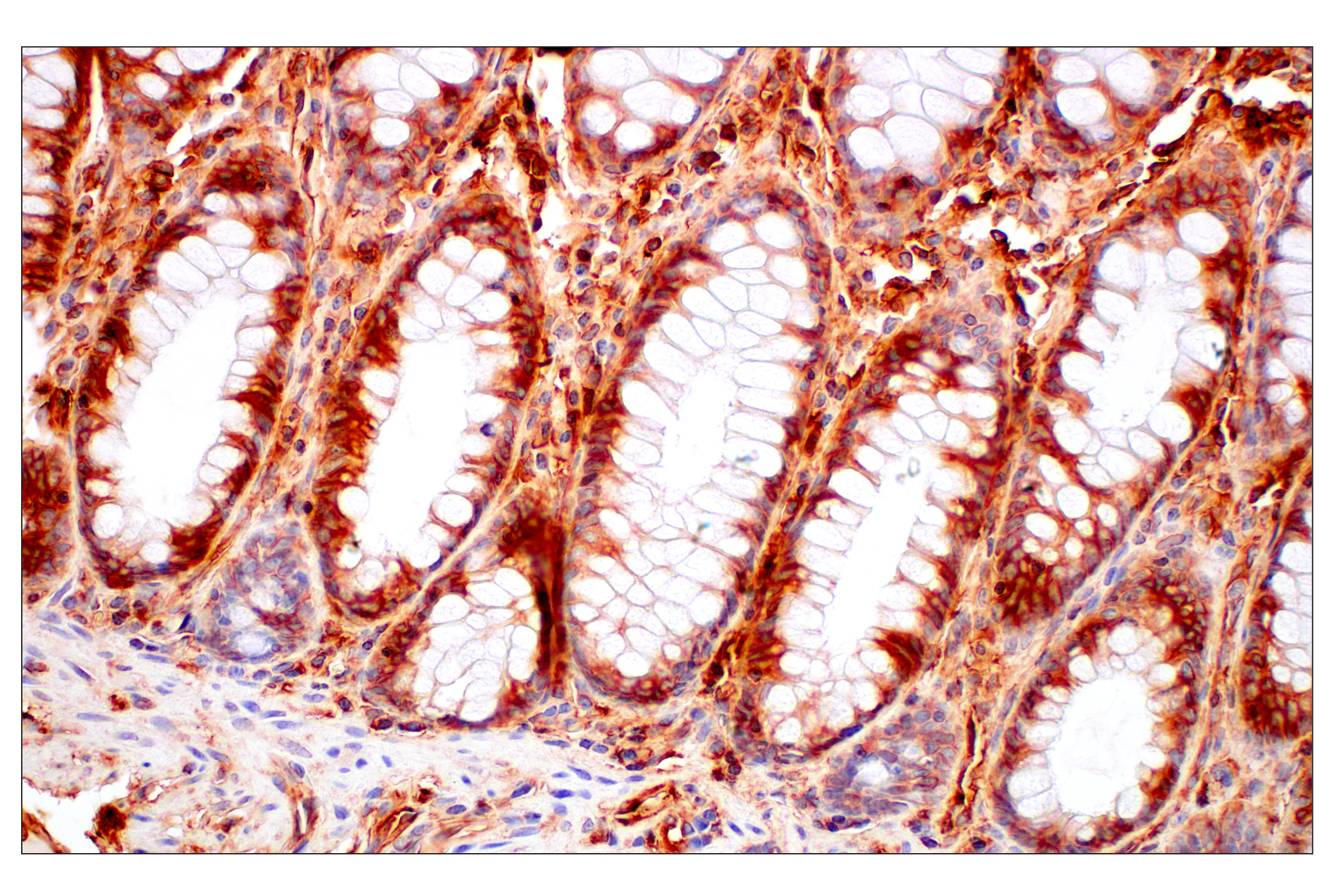 Immunohistochemistry Image 14: MHC Class I (EMR8-5) Mouse mAb (BSA and Azide Free)