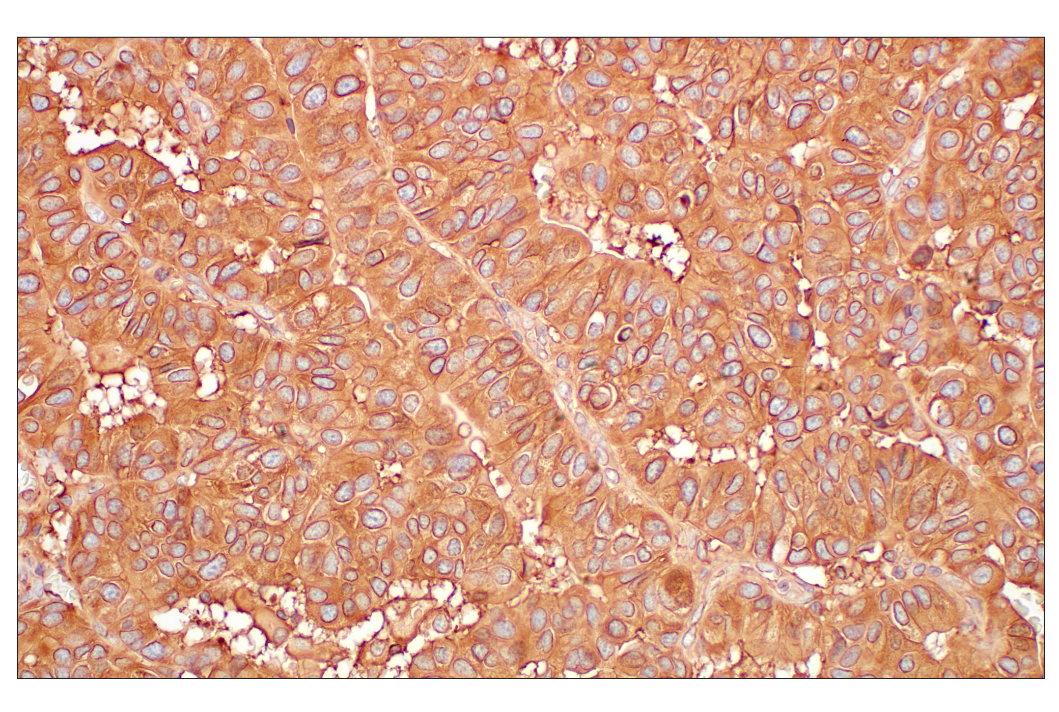 Immunohistochemistry Image 8: MHC Class I (EMR8-5) Mouse mAb (BSA and Azide Free)
