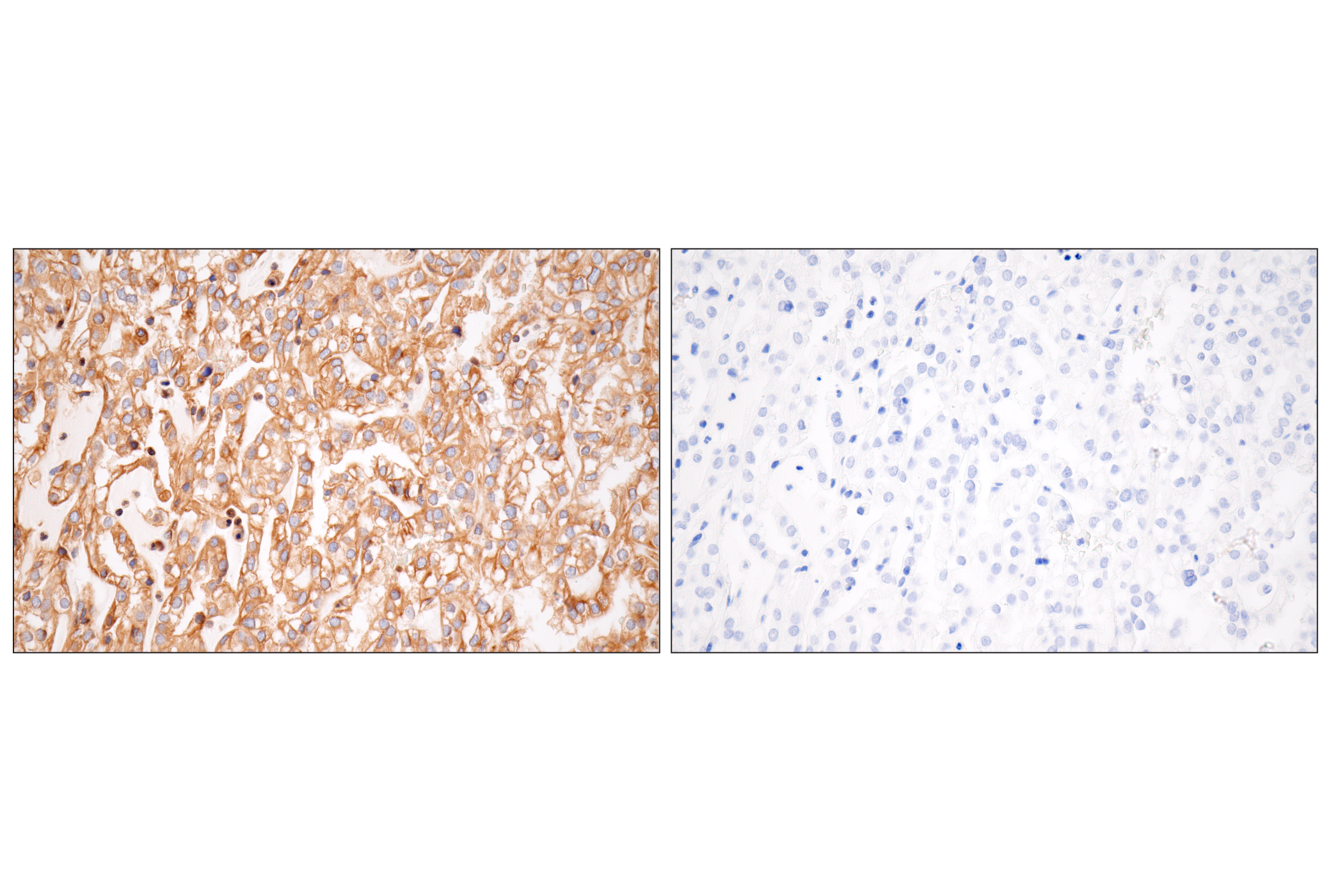 Immunohistochemistry Image 15: MHC Class I (EMR8-5) Mouse mAb (BSA and Azide Free)