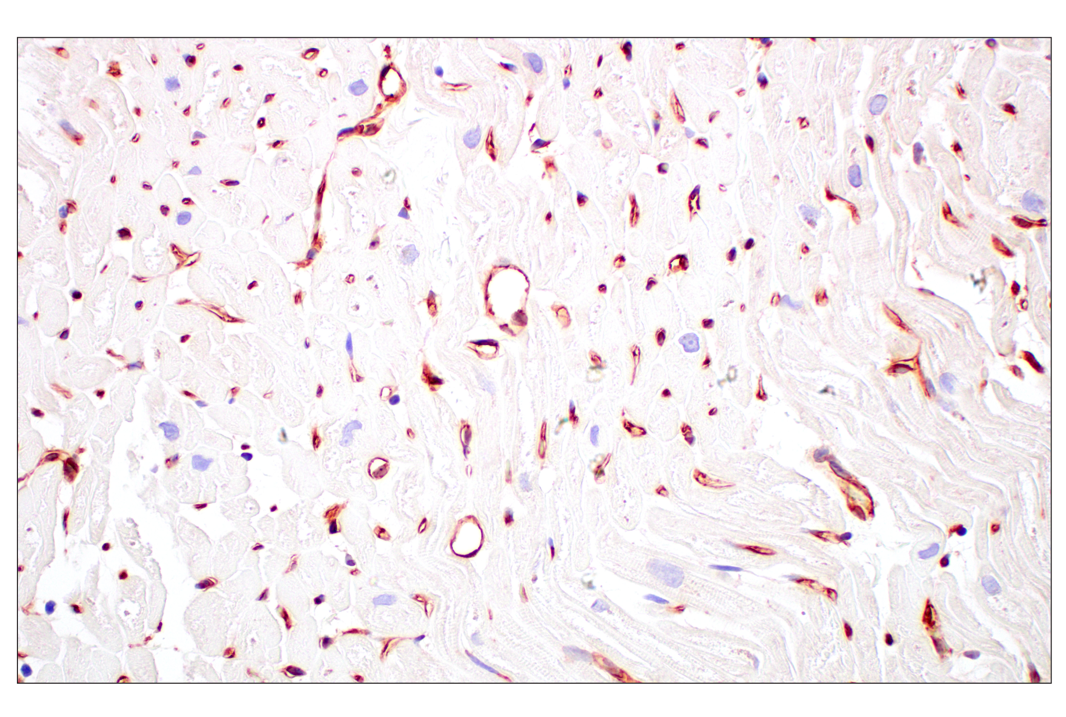Immunohistochemistry Image 13: MHC Class I (EMR8-5) Mouse mAb (BSA and Azide Free)