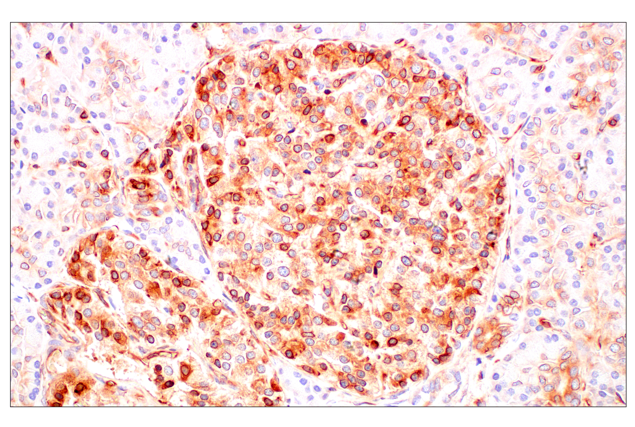 Immunohistochemistry Image 11: MHC Class I (EMR8-5) Mouse mAb (BSA and Azide Free)