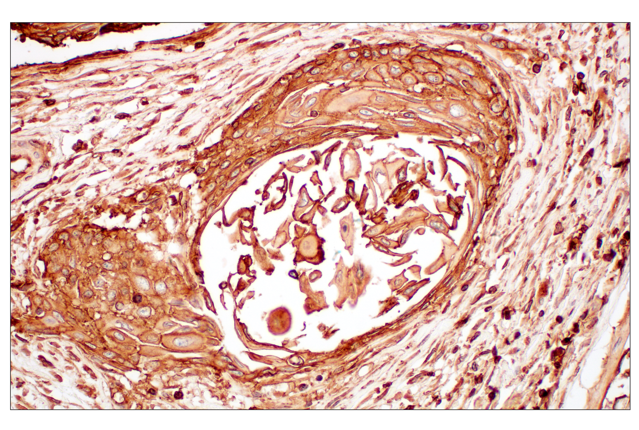 Immunohistochemistry Image 7: MHC Class I (EMR8-5) Mouse mAb (BSA and Azide Free)