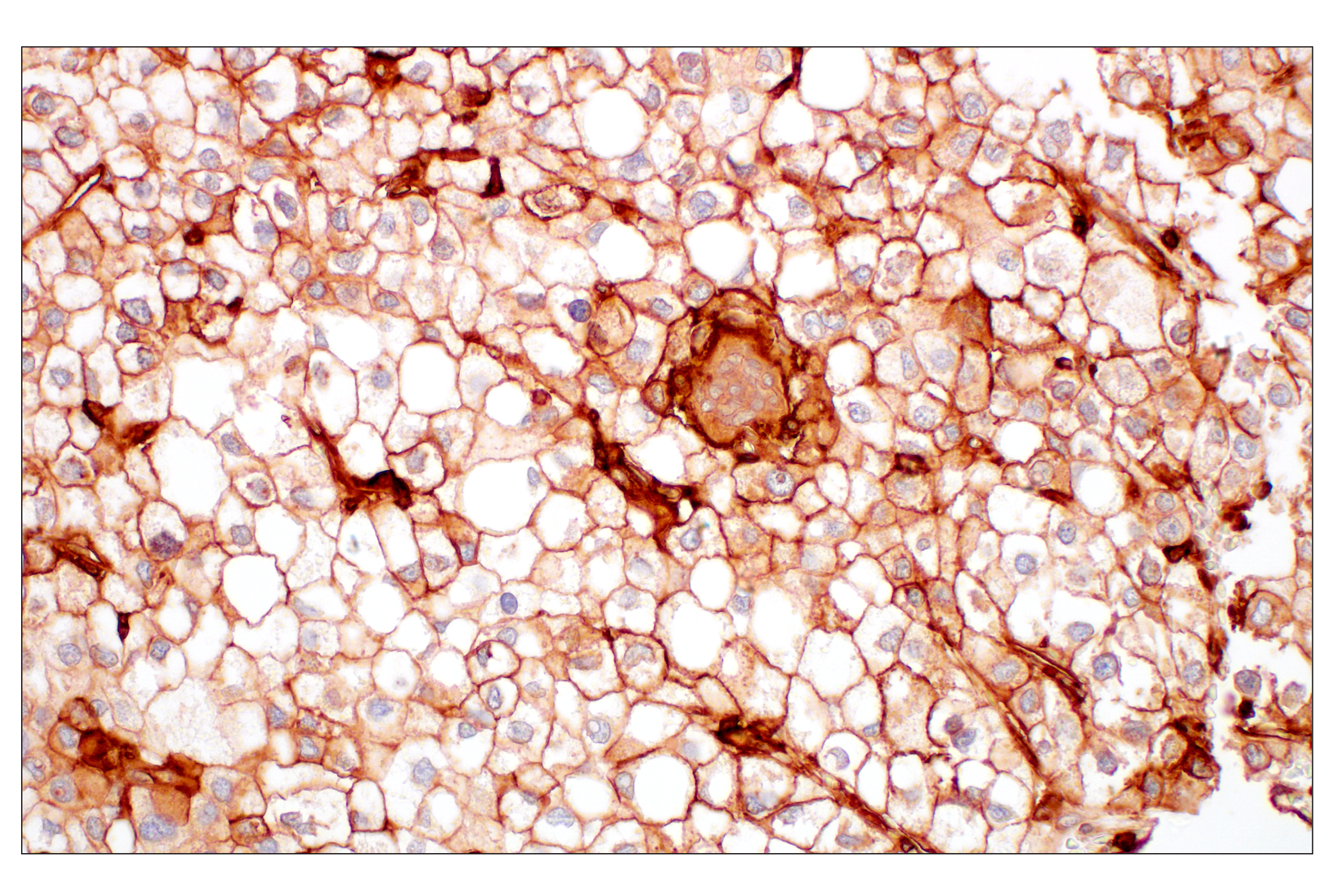 Immunohistochemistry Image 1: MHC Class I (EMR8-5) Mouse mAb (BSA and Azide Free)