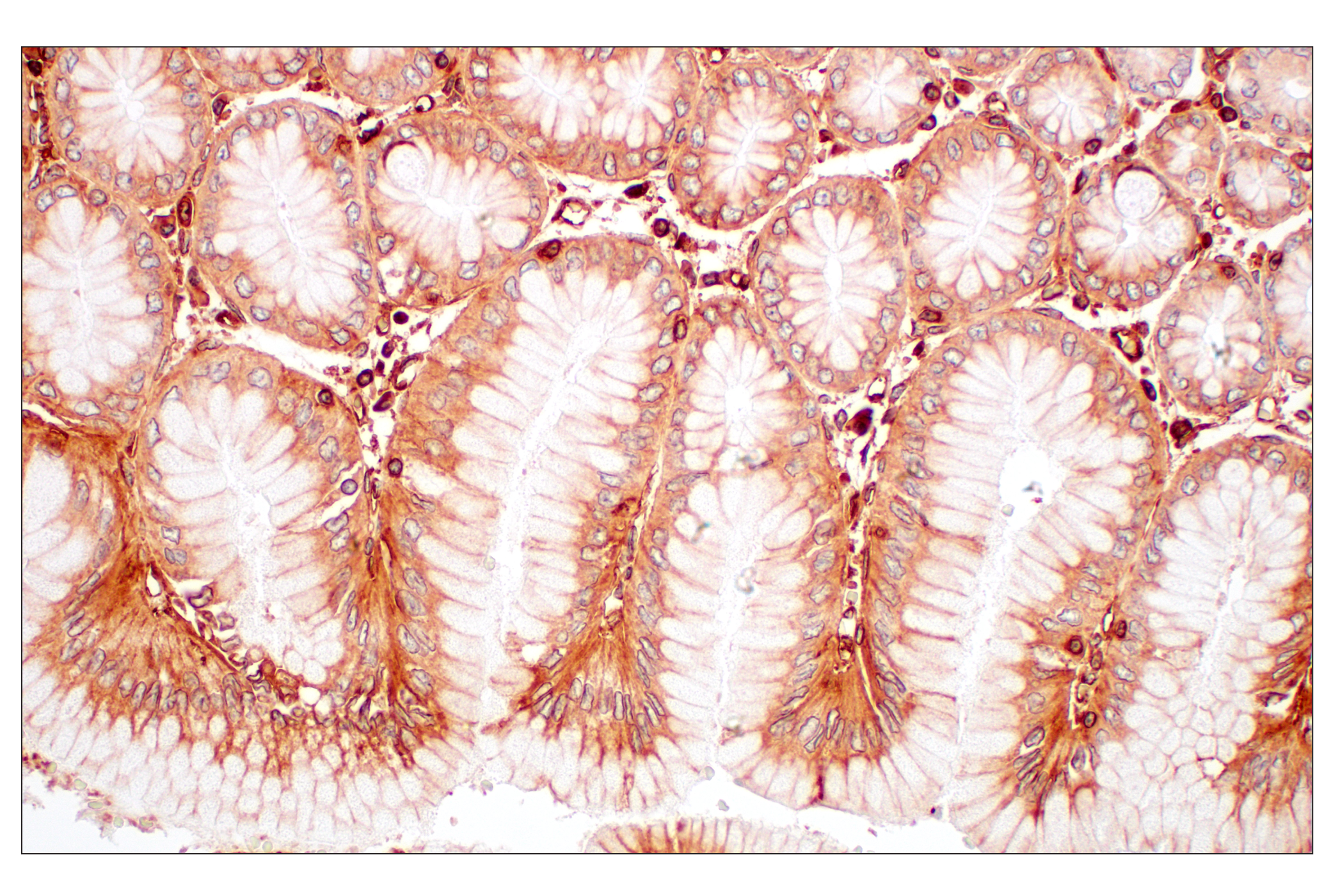 Immunohistochemistry Image 3: MHC Class I (EMR8-5) Mouse mAb (BSA and Azide Free)