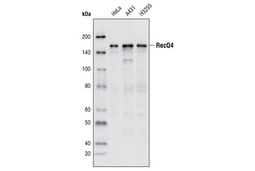 Western Blotting Image 1: RecQ4 Antibody