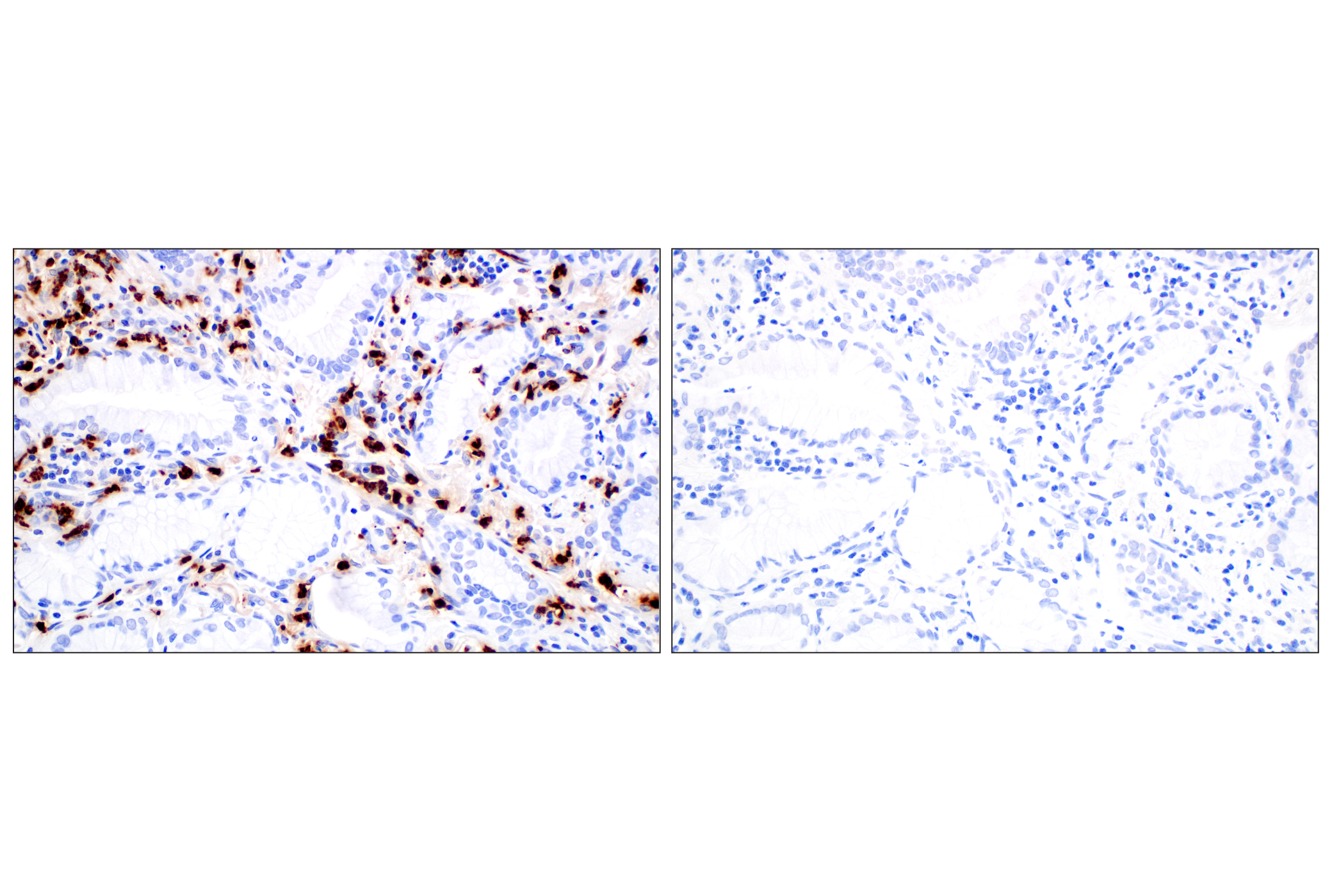 Immunohistochemistry Image 10: Neutrophil Elastase (F4H3X) Rabbit mAb