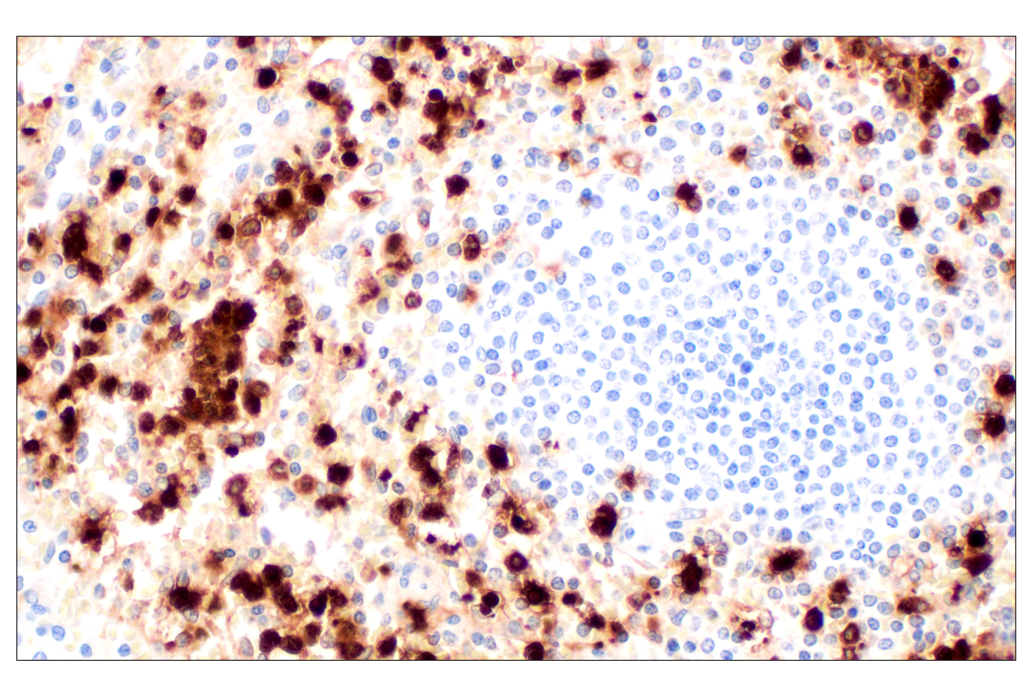 Immunohistochemistry Image 6: Neutrophil Elastase (F4H3X) Rabbit mAb