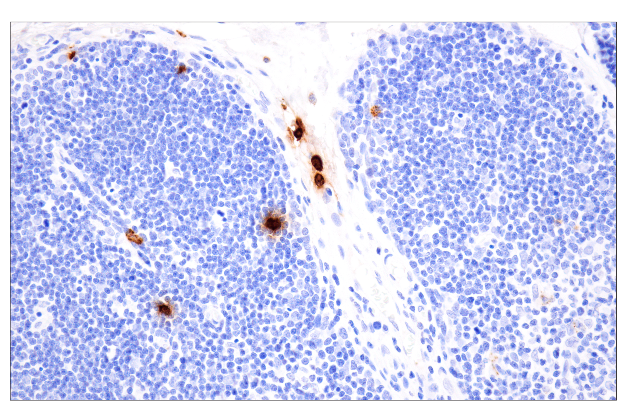 Immunohistochemistry Image 7: Neutrophil Elastase (F4H3X) Rabbit mAb
