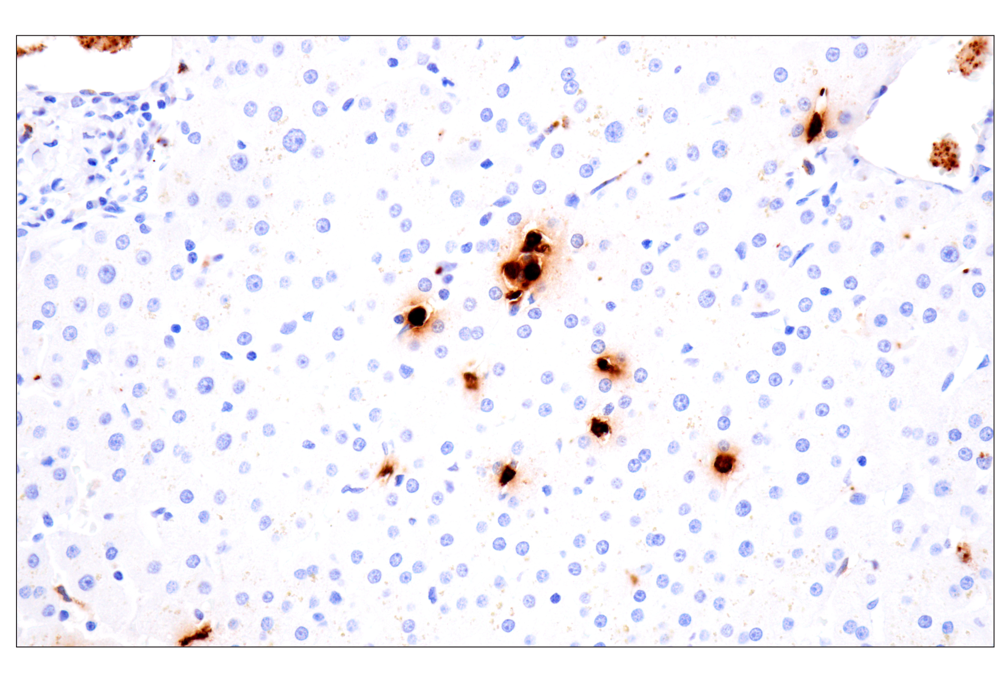 Immunohistochemistry Image 9: Neutrophil Elastase (F4H3X) Rabbit mAb