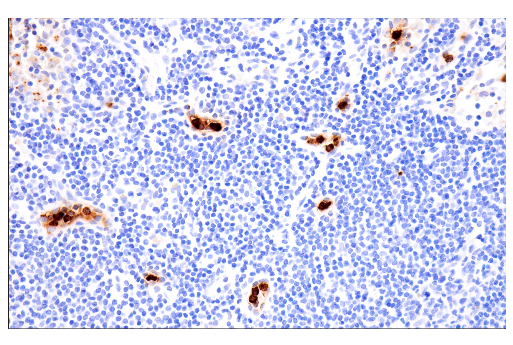 Immunohistochemistry Image 8: Neutrophil Elastase (F4H3X) Rabbit mAb