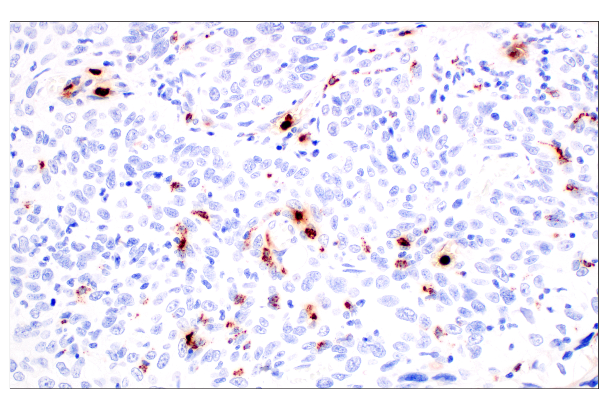 Immunohistochemistry Image 3: Neutrophil Elastase (F4H3X) Rabbit mAb