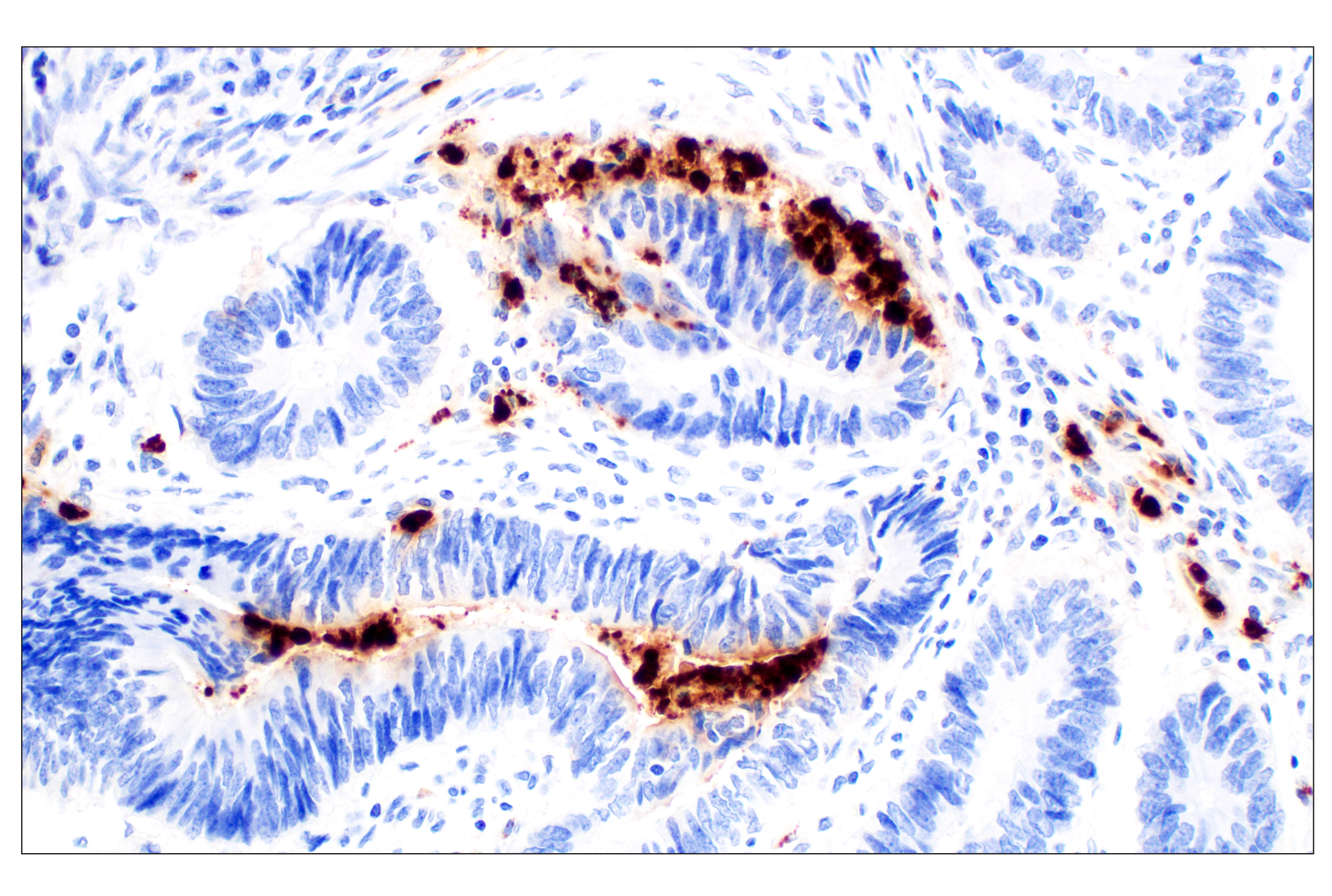 Immunohistochemistry Image 1: Neutrophil Elastase (F4H3X) Rabbit mAb
