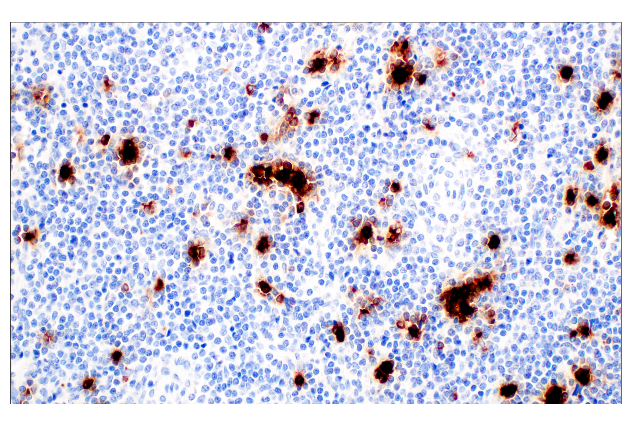 Immunohistochemistry Image 2: Neutrophil Elastase (F4H3X) Rabbit mAb