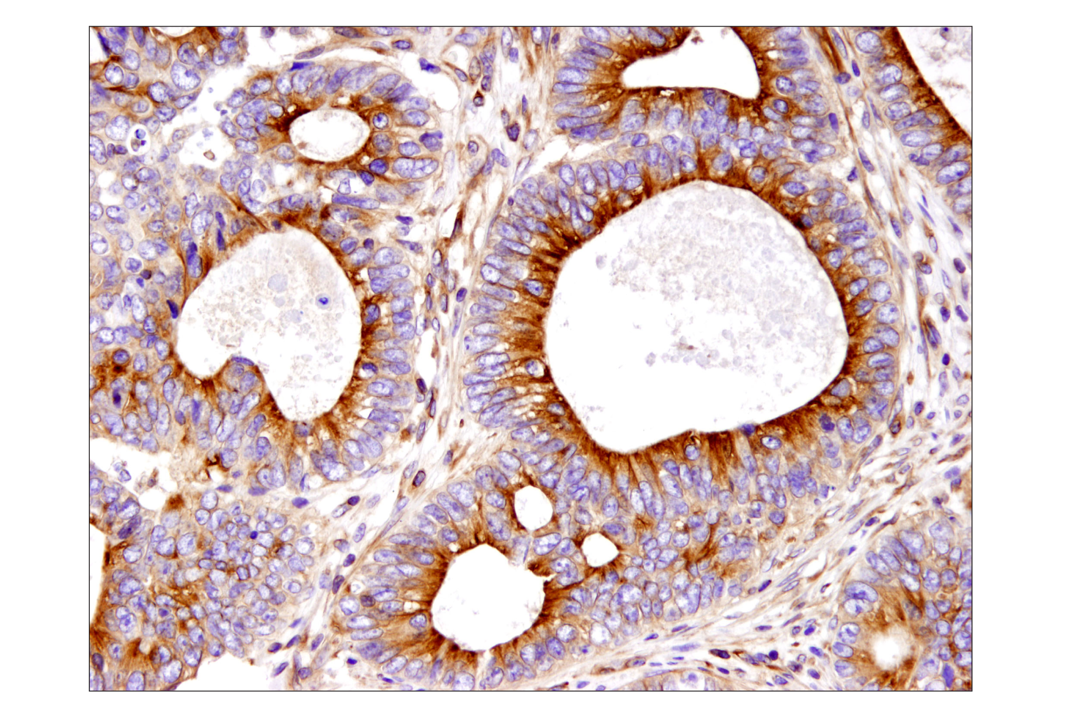 Immunohistochemistry Image 1: β-Tubulin (D3U1W) Mouse mAb (BSA and Azide Free)