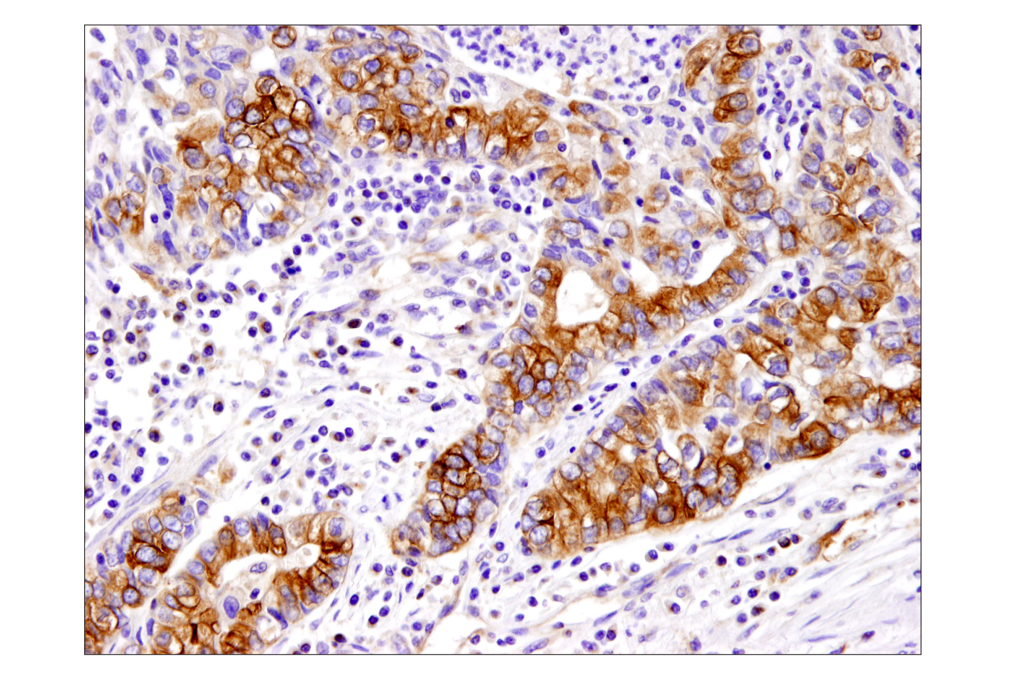 Immunohistochemistry Image 3: β-Tubulin (D3U1W) Mouse mAb (BSA and Azide Free)