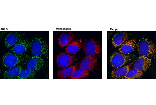 Immunofluorescence Image 1: Grp75 Antibody