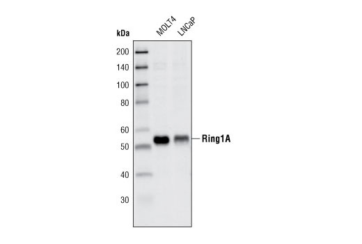 Western Blotting Image 1: Ring1A Antibody