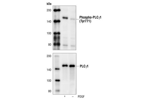 Western Blotting Image 1: Phospho-PLCgamma1 (Tyr771) Antibody