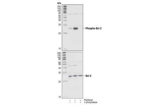  Image 9: Pro-Survival Bcl-2 Family Antibody Sampler Kit II