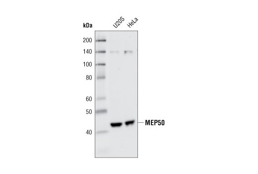 Western Blotting Image 1: MEP50 (P328) Antibody