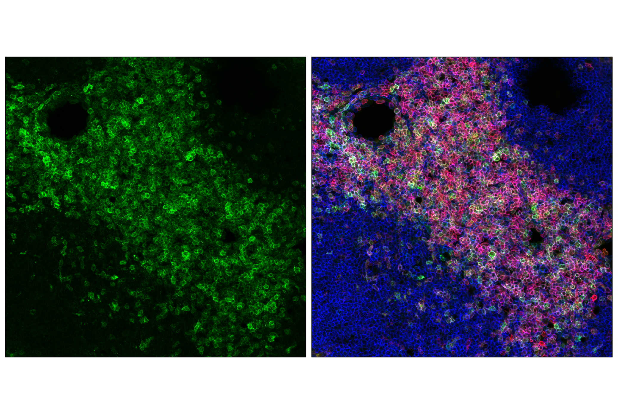 Immunofluorescence Image 1: CD5 (E5O4W) Rabbit mAb