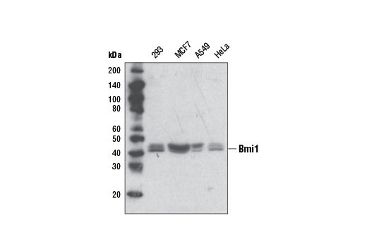 Western Blotting Image 1: Bmi1 Antibody