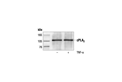 Immunoprecipitation Image 1: cPLA2 Antibody