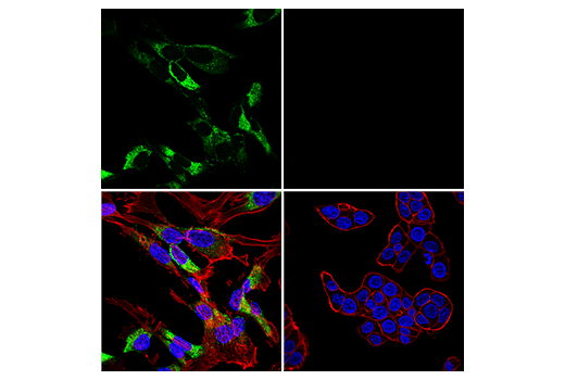 Immunofluorescence Image 4: COL1A1 (E8F4L) XP® Rabbit mAb (Alexa Fluor® 488 Conjugate)