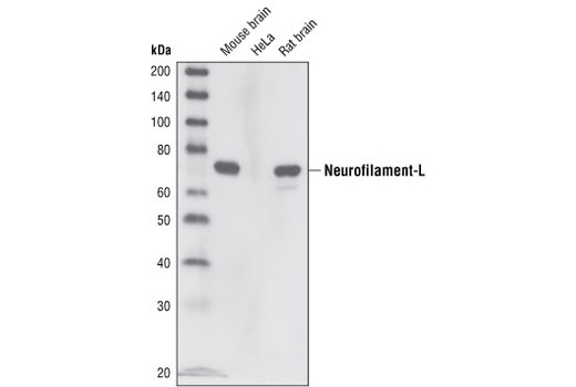  Image 4: Mature Neuron Marker Antibody Sampler Kit