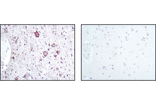 Immunohistochemistry Image 2: Neurofilament-L (C28E10) Rabbit mAb