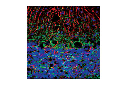 Immunofluorescence Image 1: Neurofilament-L (C28E10) Rabbit mAb