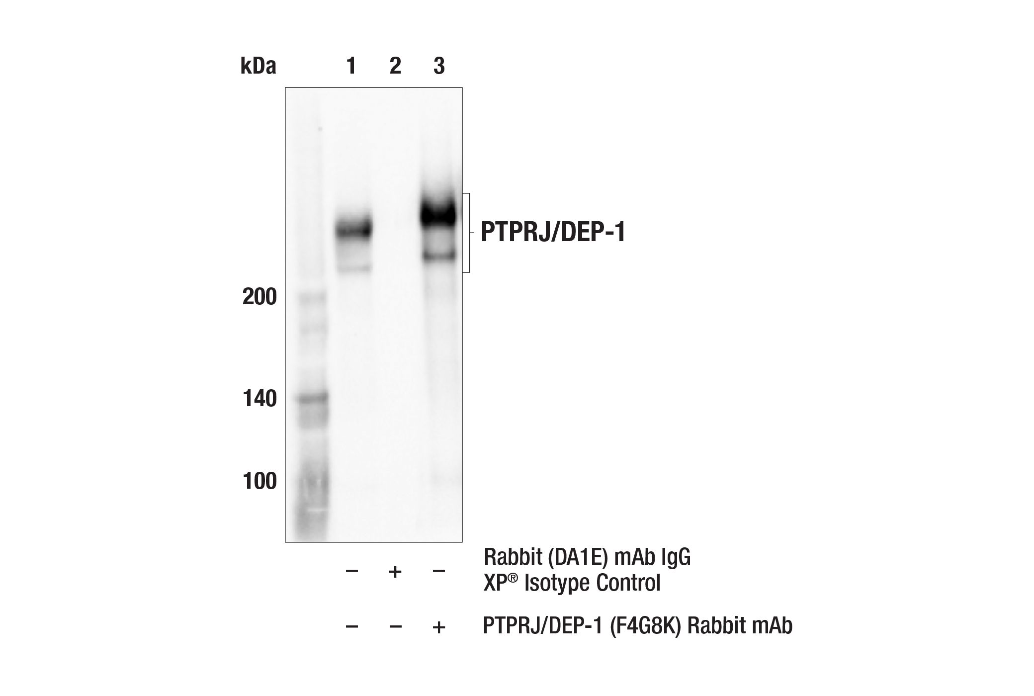 Immunoprecipitation Image 1: PTPRJ/DEP-1 (F4G8K) Rabbit mAb