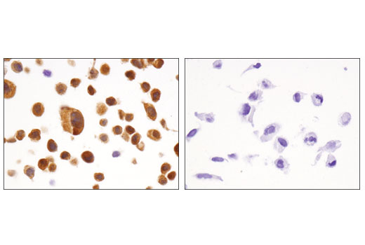 Immunohistochemistry Image 2: FABP5 (D1A7T) Rabbit mAb (BSA and Azide Free)