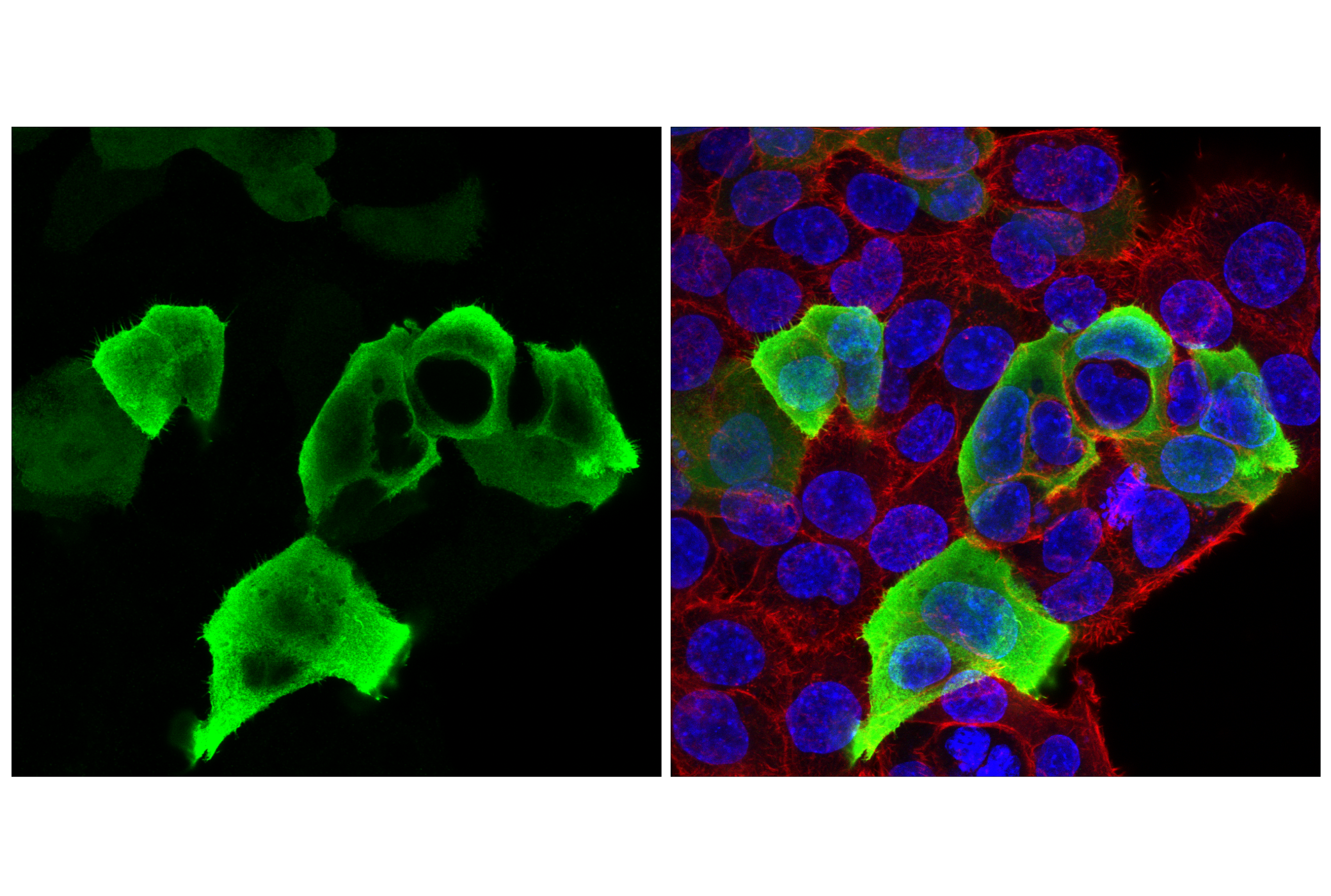 Immunofluorescence Image 1: HA-Tag (C29F4) Rabbit mAb (Alexa Fluor® 488 Conjugate)
