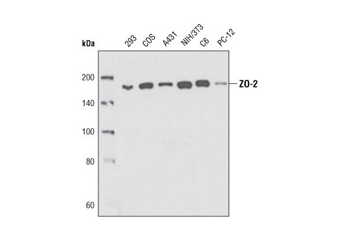 Western Blotting Image 1: ZO-2 Antibody